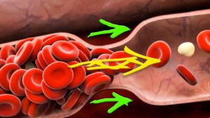 Read more about the article 6 remedii eficiente pentru subțierea sângelui din corp