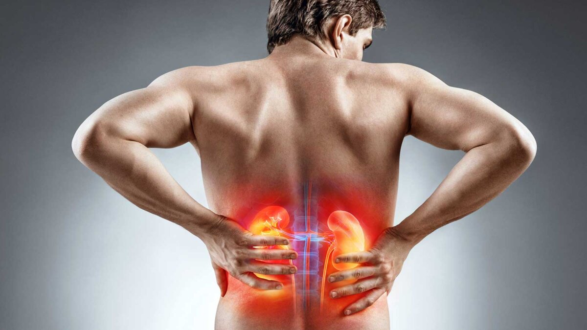 durere de spate sau rinichi