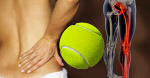 Read more about the article Cum să scapi de durerea provocată de nervul sciatic cu o minge de tenis