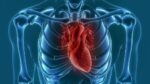 Miocardita – simptome și tratament