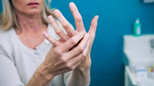 Read more about the article Artrita reumatoidă – Cauzele, simptomele, etapele și diagnosticul