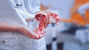 Read more about the article Adenomioza uterină – simptome și tratament