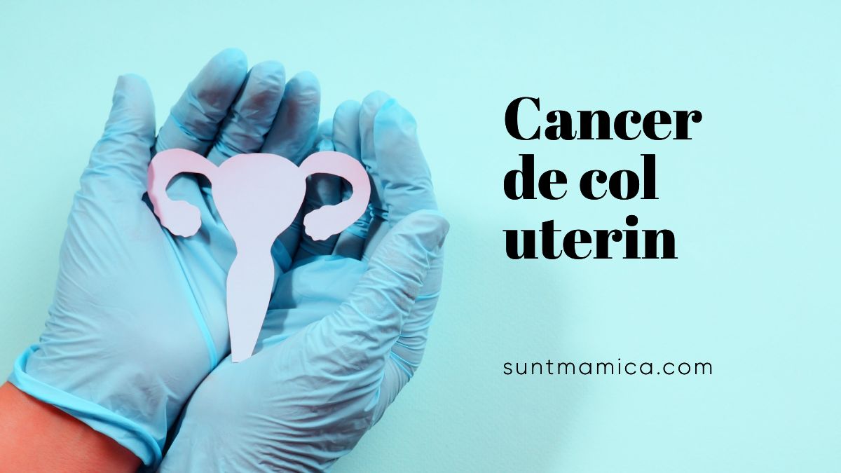 Read more about the article Cancer de col uterin – Cauze, simptome, tratament
