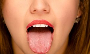 Read more about the article Urme de dinți pe limbă. Despre ce probleme de sănătate vorbesc?
