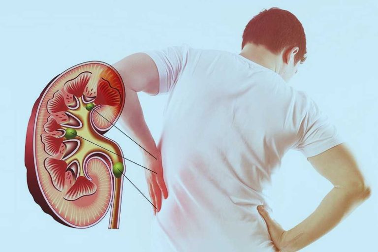 Cum să previi și să tratezi problemele renale prin nutriție