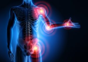 Read more about the article Glucozamină și condroitina pentru durerile articulare