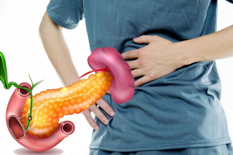Tratament pentru pancreas: 5 reguli pentru a-l menține în ordine